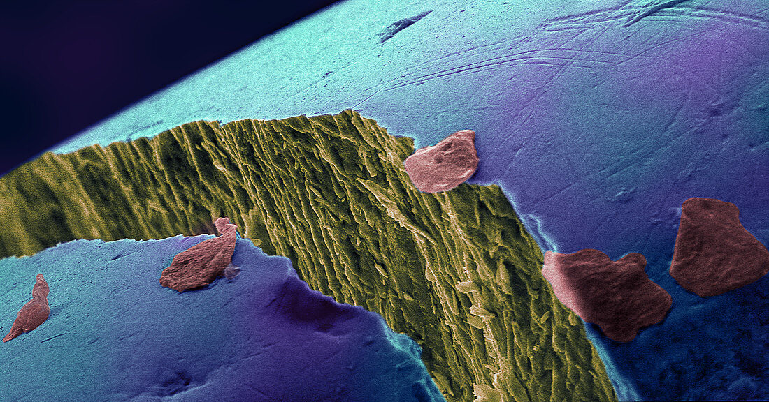 Human Tooth Crack with Cheek Cells,SEM