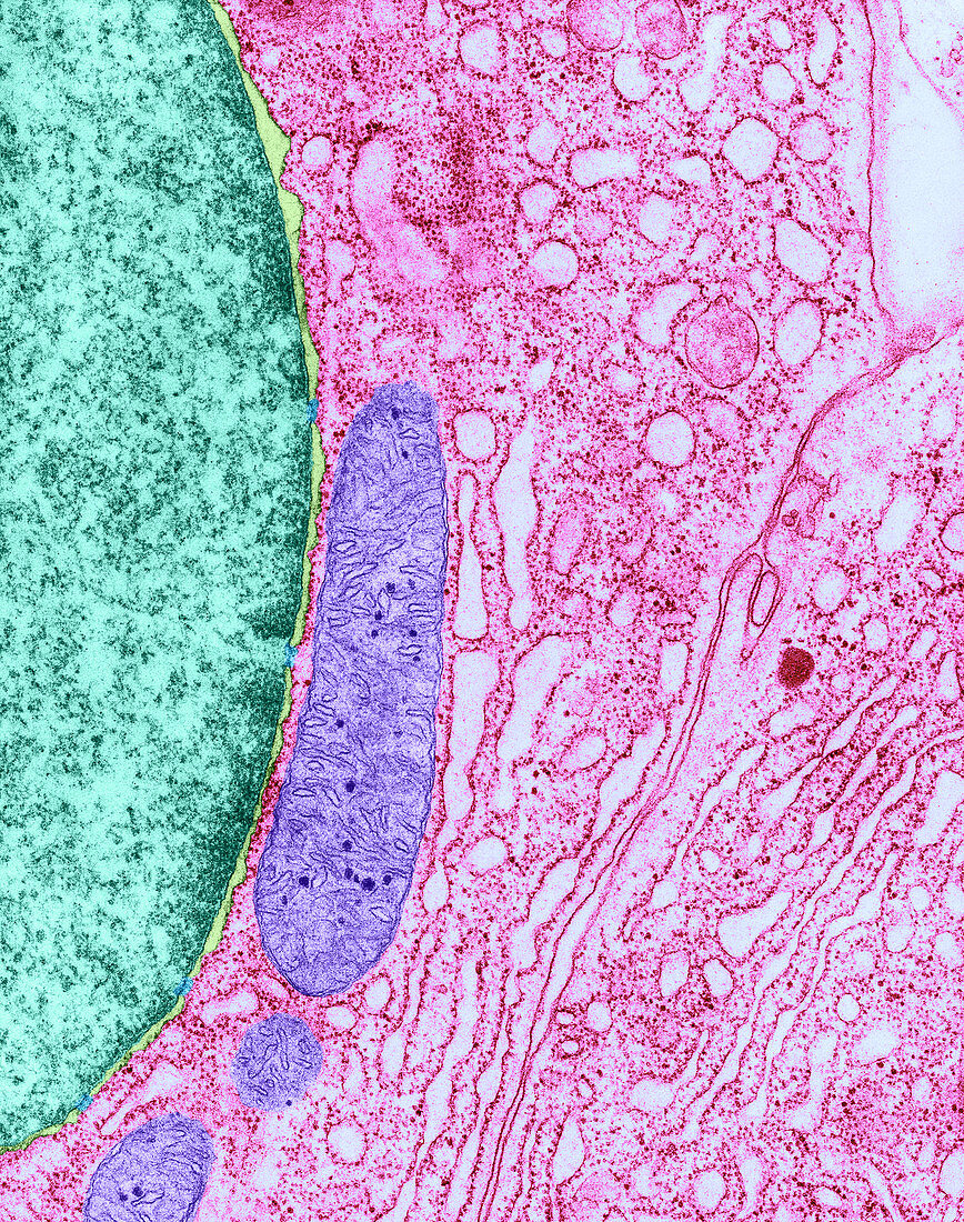 Nuclear Membrane,TEM