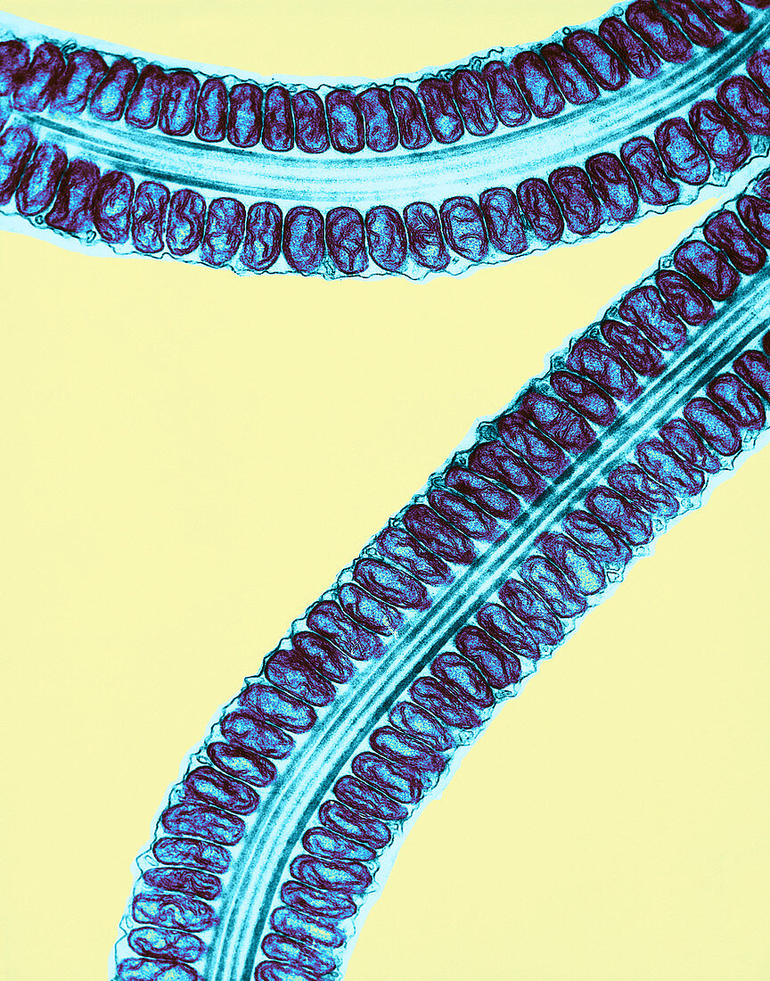 Mitochondria of Spermatozoa,TEM