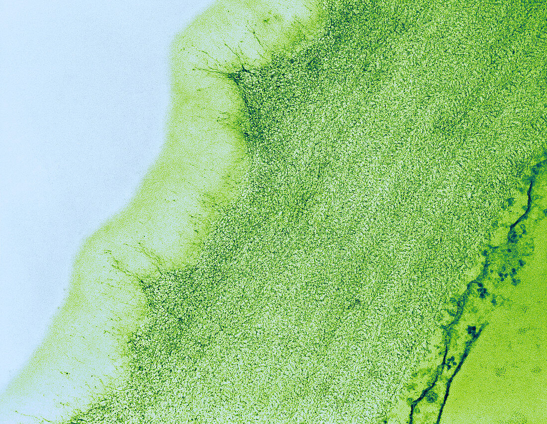 Celery,Cuticle of Epidermal Cell,TEM
