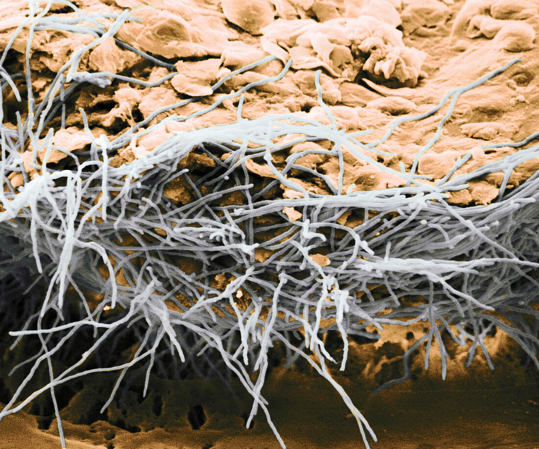 Hyphae on Human Skin,SEM