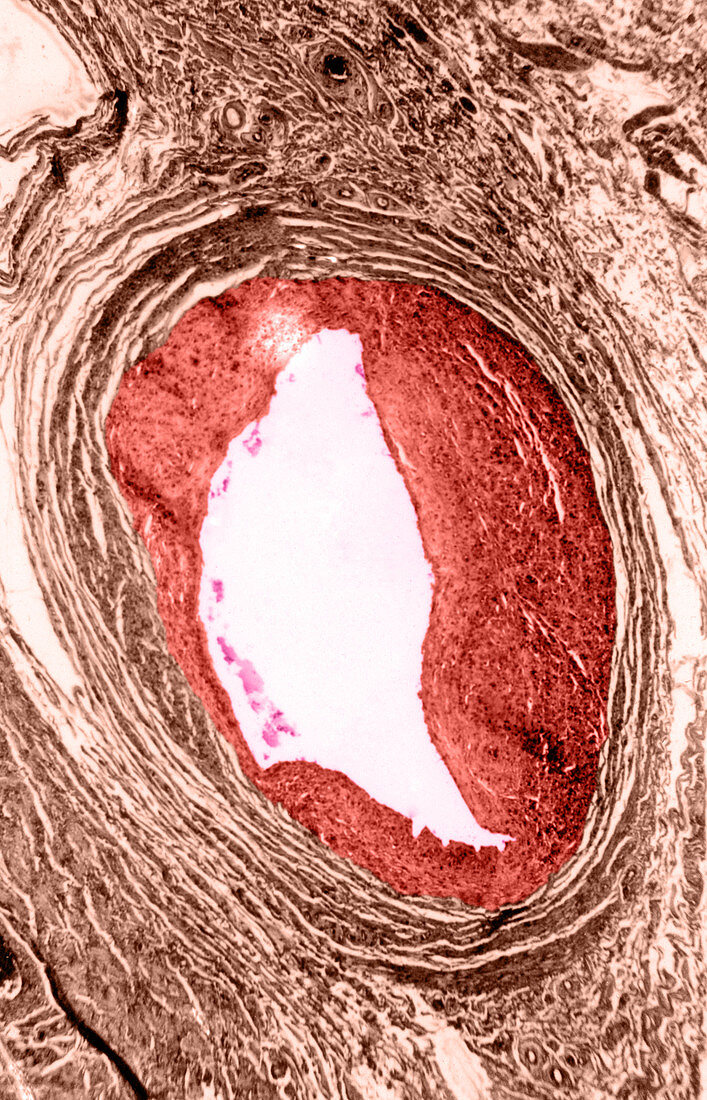 Veins of Penis,LM