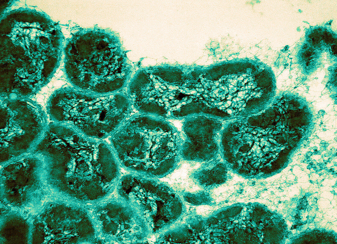 Bacterial Chromosomes,TEM