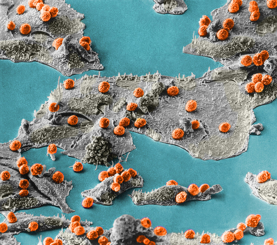 Immune Cells Attacking Cancer Cells,SEM