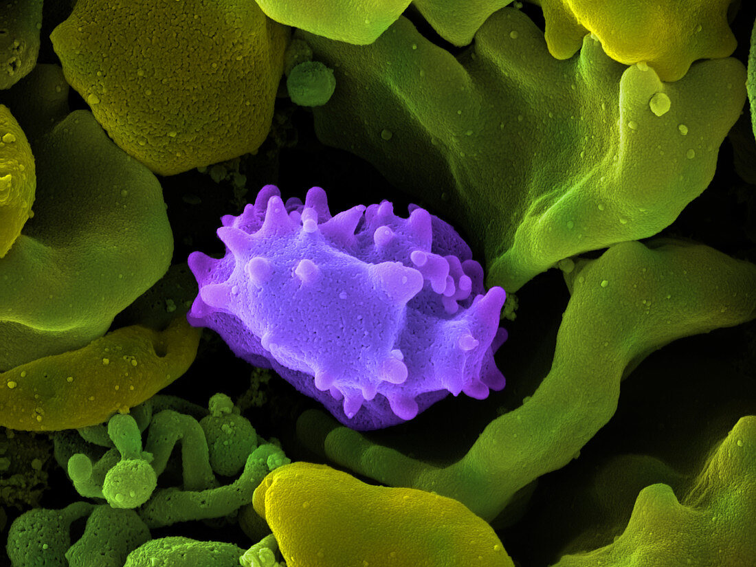 Human Lymphocyte Cell,SEM