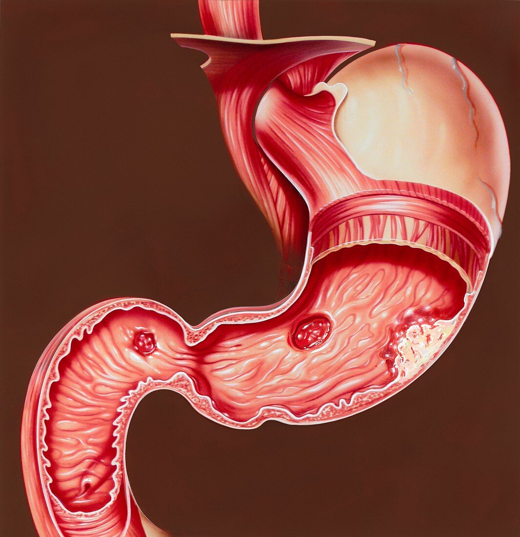Gastrointestinal disorders,illustration