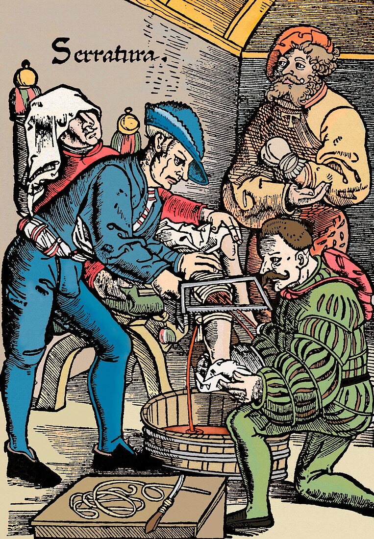 16th century battlefield medicine