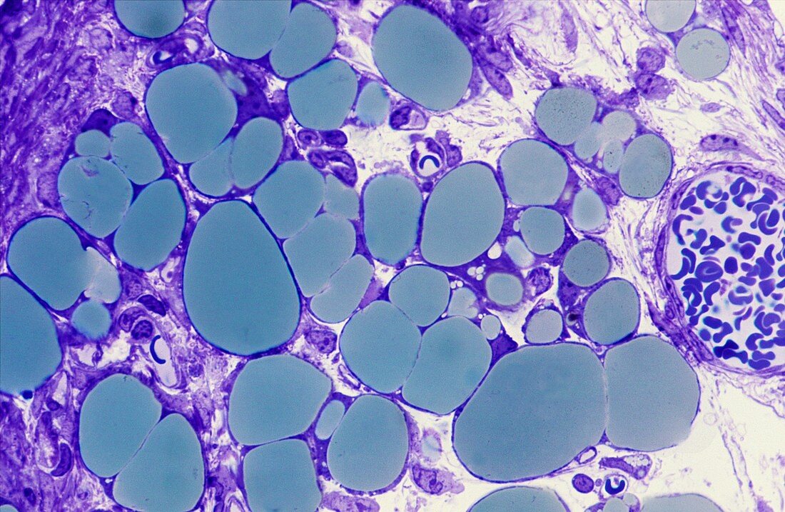 Human fat cells,light micrograph