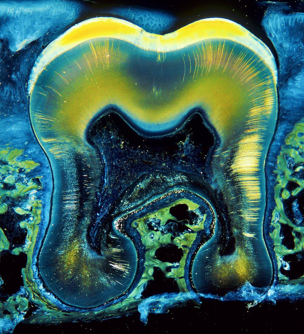 Human tooth,light micrograph