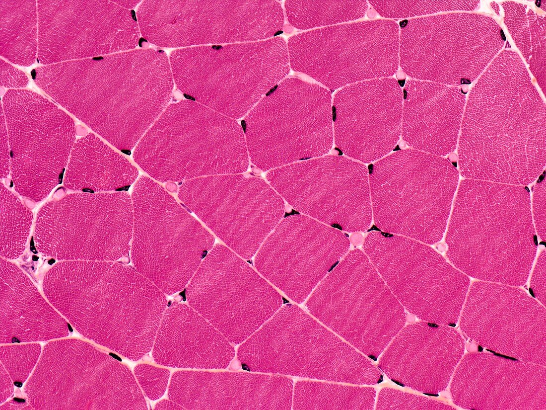 Skeletal muscle,light micrograph