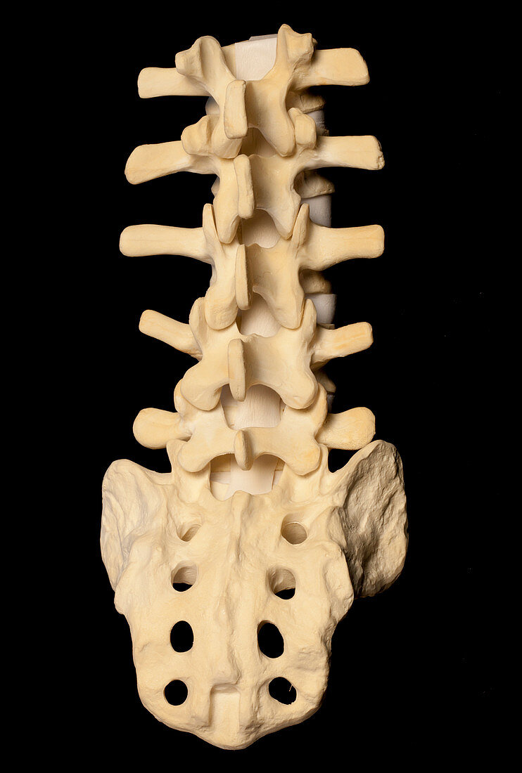 3D printed anatomical lower spine model