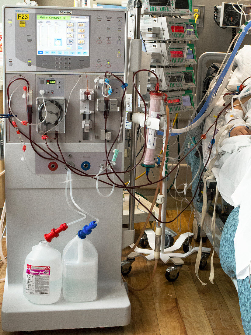 Haemodialysis machine