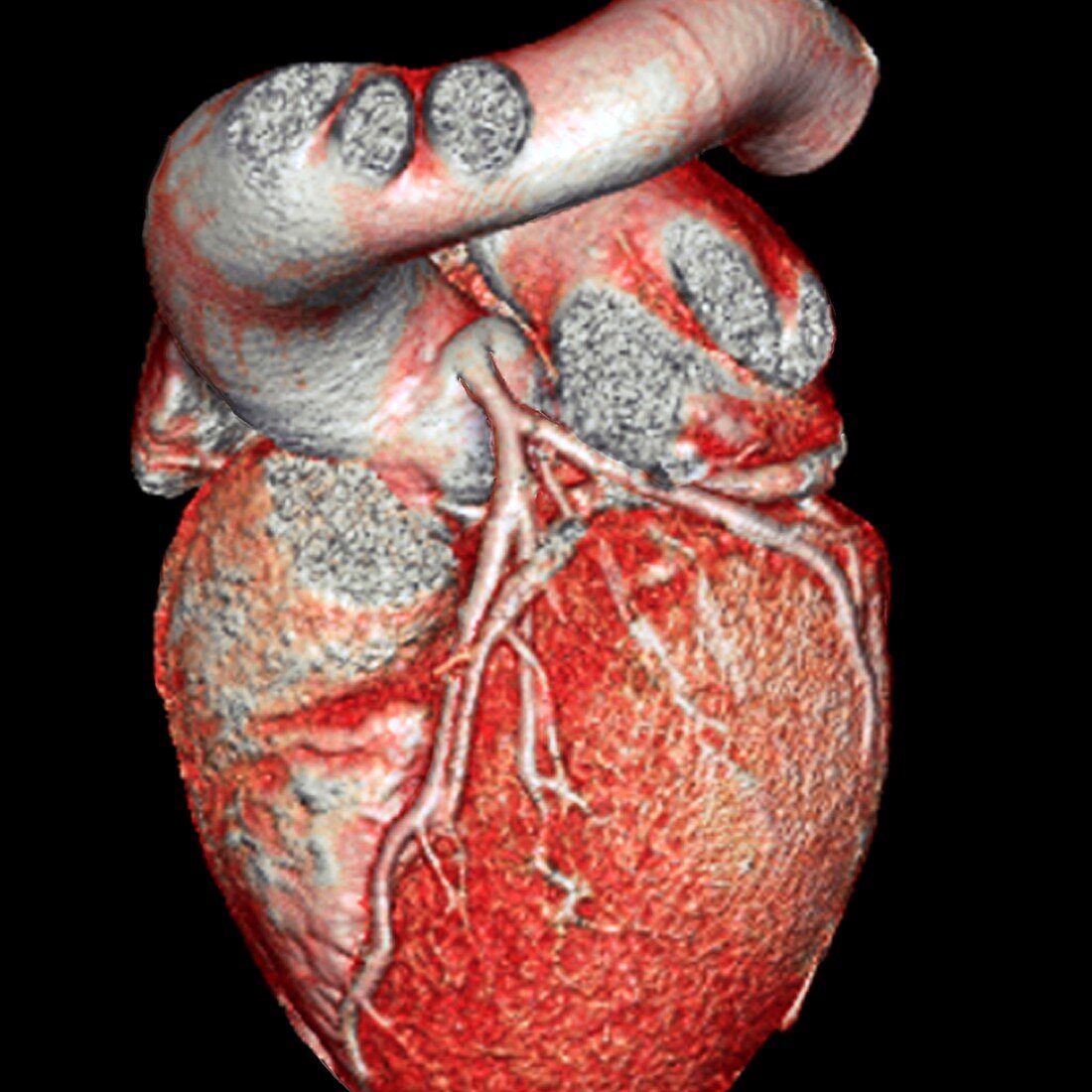 Healthy heart,3D CT scan