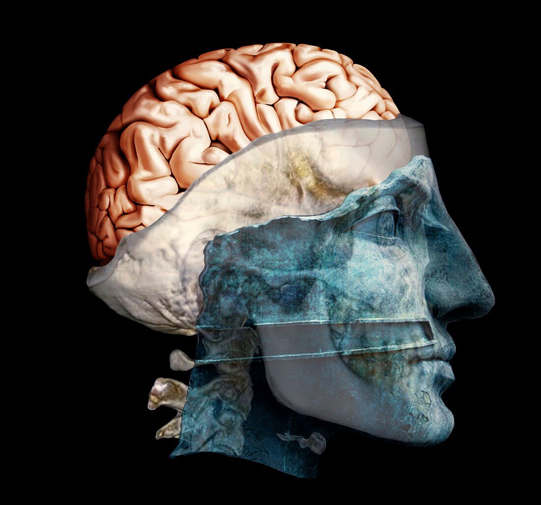 Thought,conceptual 3D CT image
