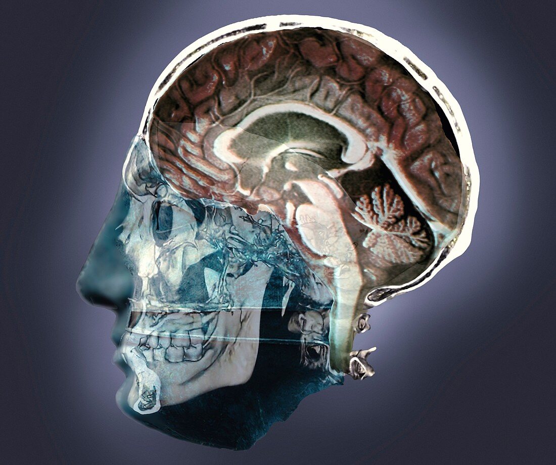 Thought,conceptual 3D MRI and CT image