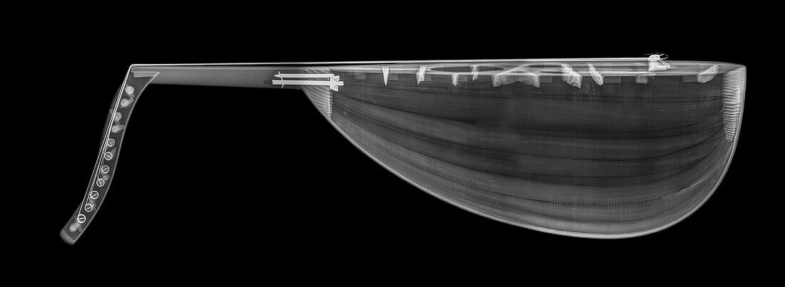 X-ray of an Oud