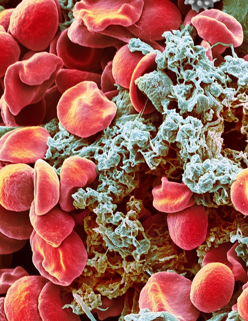 Red blood cells and platelets,SEM