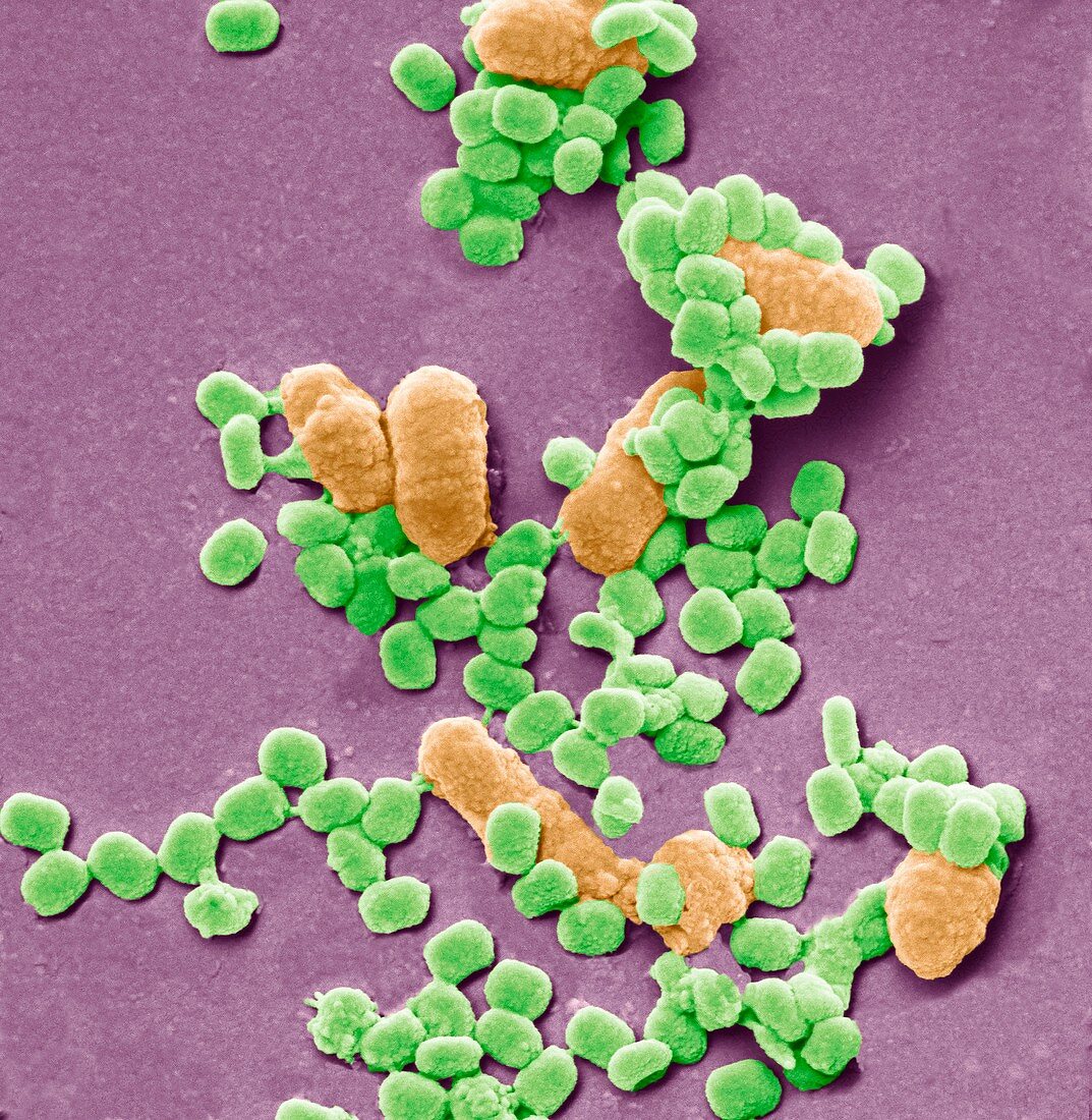 Virus particles and bacteria,SEM