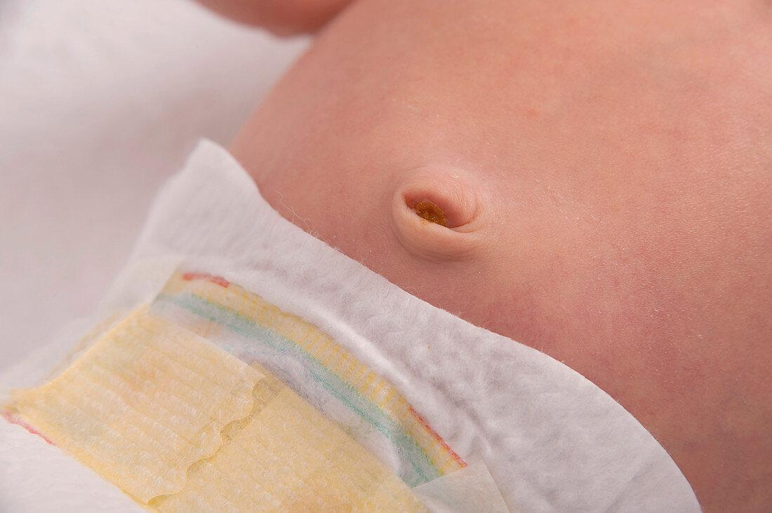 Newborn baby's navel