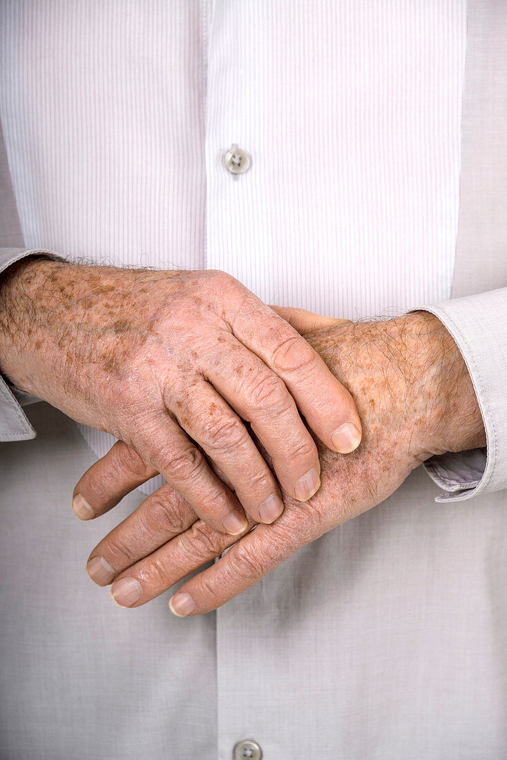 Senior man holding his hand