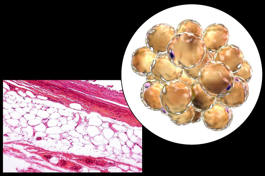 Fat cells,illustration