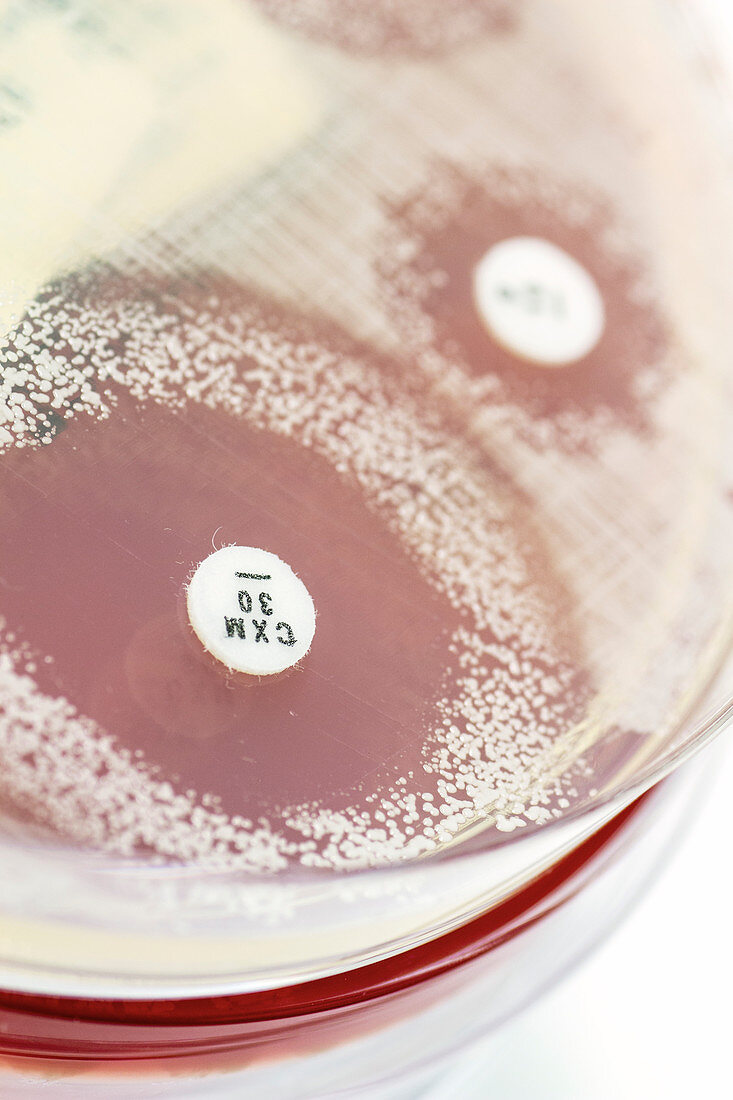 Staphylococcus culture and antibiotics