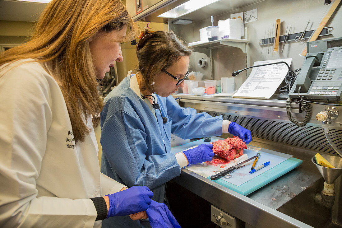 Pathologists examine a uterine tumour