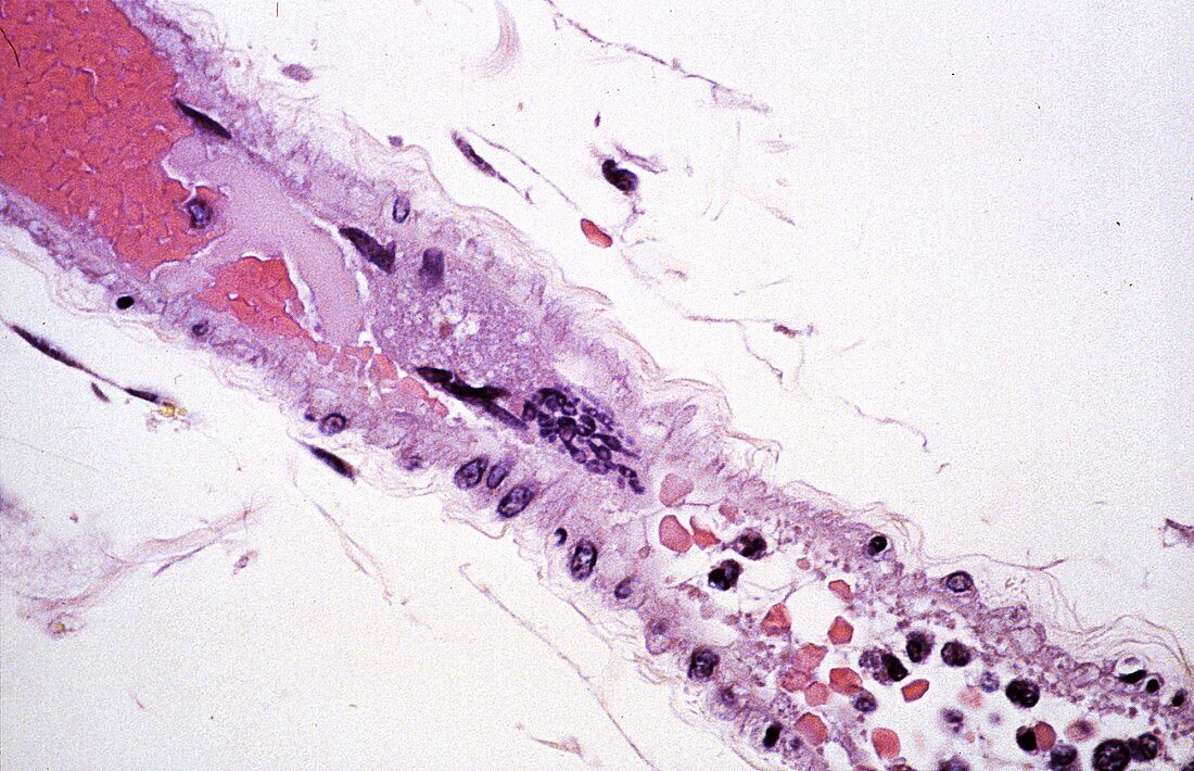 Nipah virus infection, light micrograph