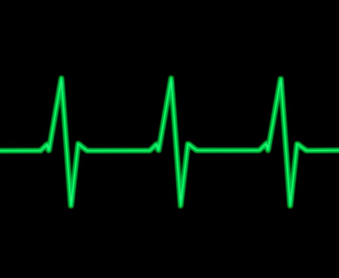 ECG heartbeat trace, illustration