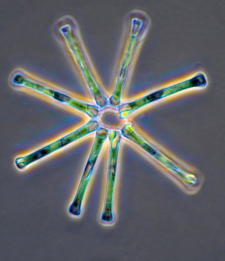 Stellate diatom, light micrograph