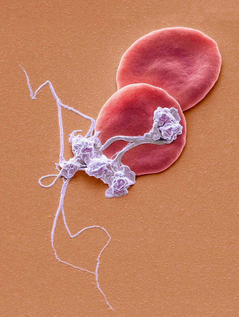 Blood from wound site, SEM