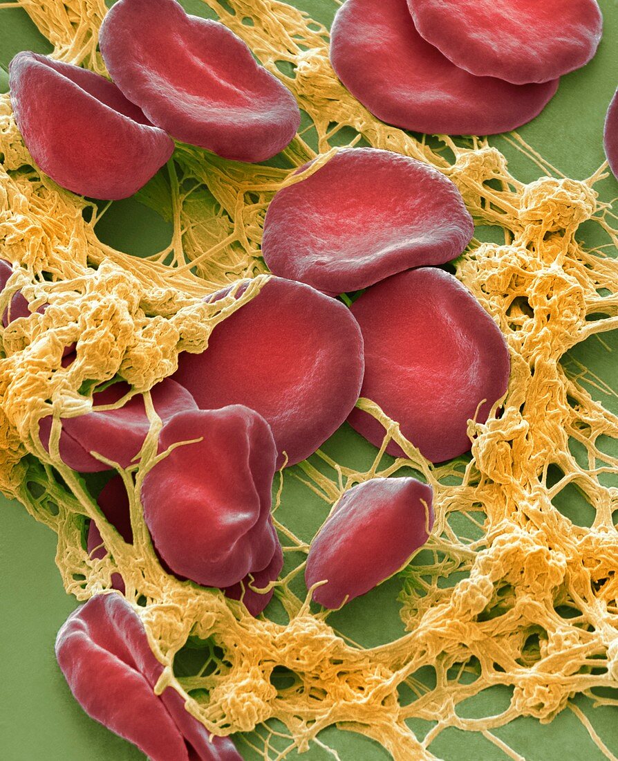 Blood from wound site, SEM