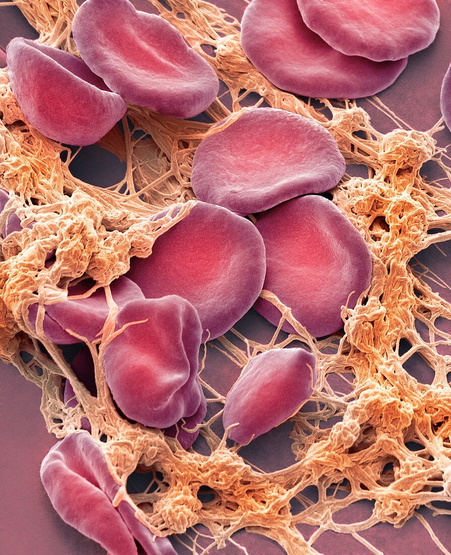 Blood from wound site, SEM