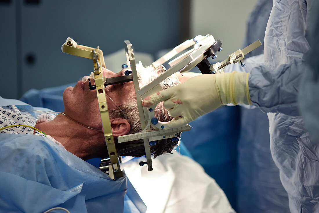 Deep brain stimulation surgery