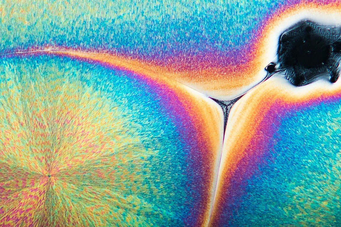 Vitamin C birefringence, polarised light micrograph