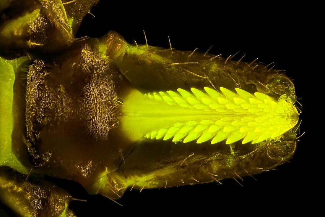 Tick head, light micrograph