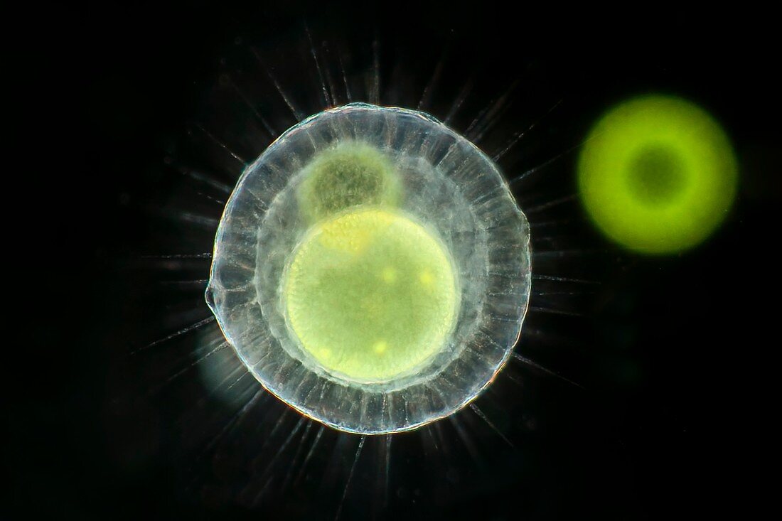 Heliozoa feeding on volvox, light micrograph