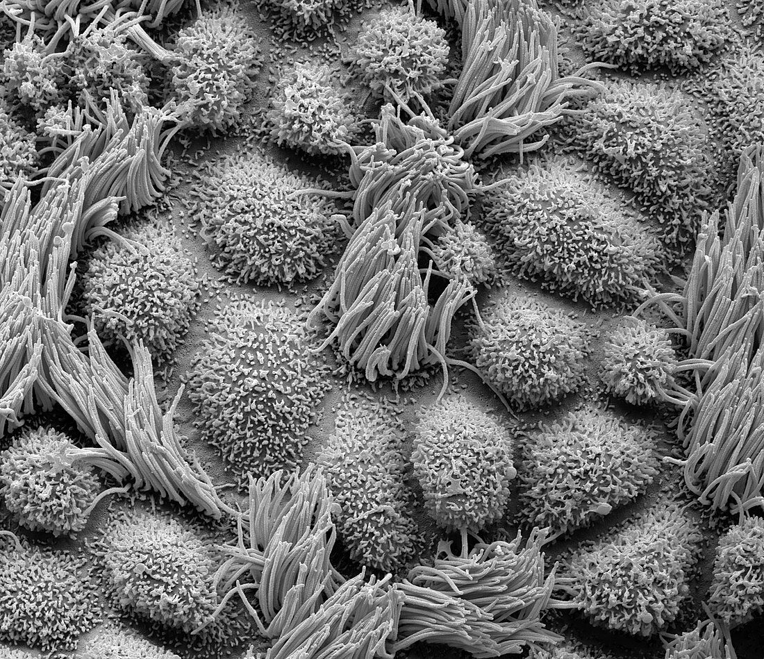 Fallopian tube, SEM