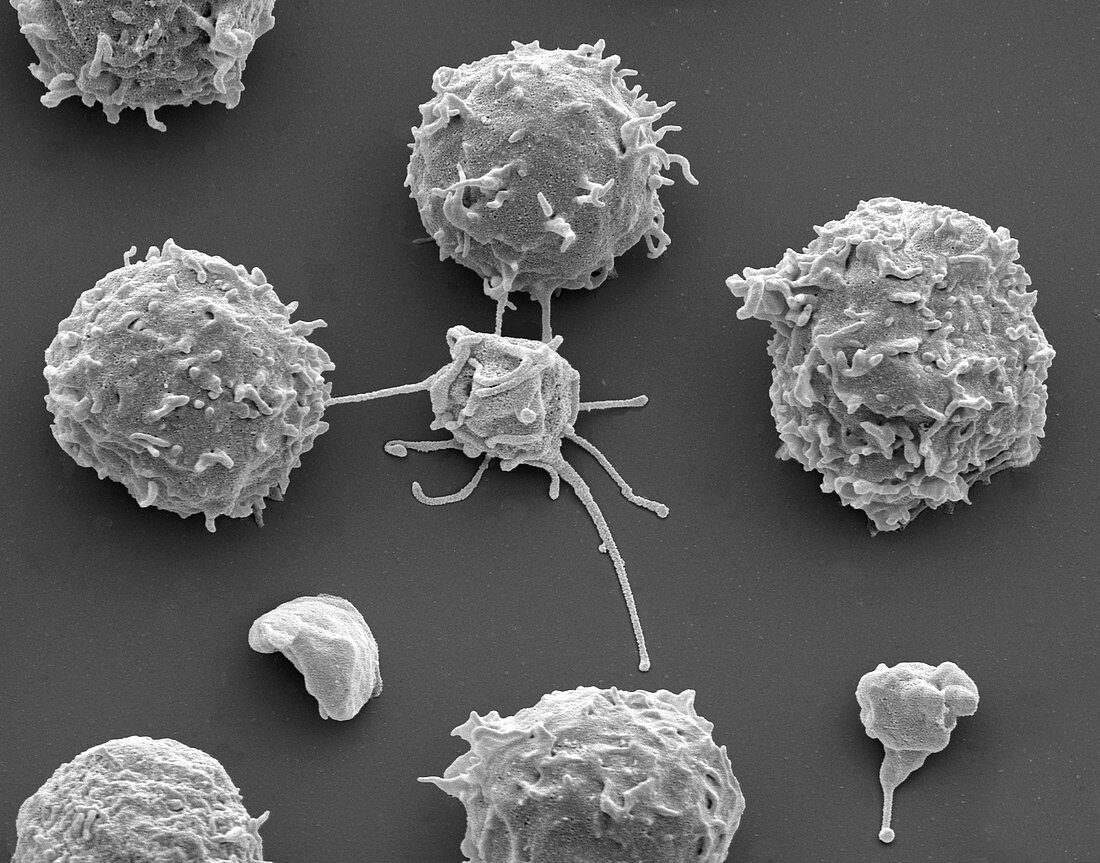 White blood cells and platelets, SEM