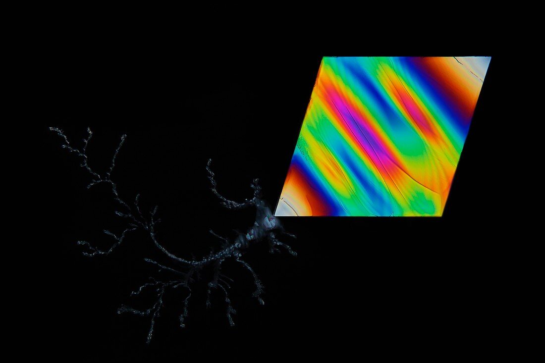 Glutamic acid neurotransmitter crystals, light micrograph