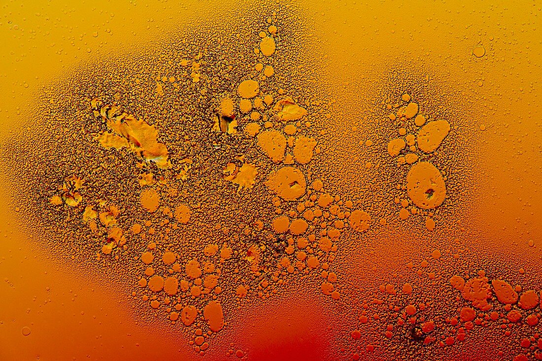 Heparin drug crystals, light micrograph
