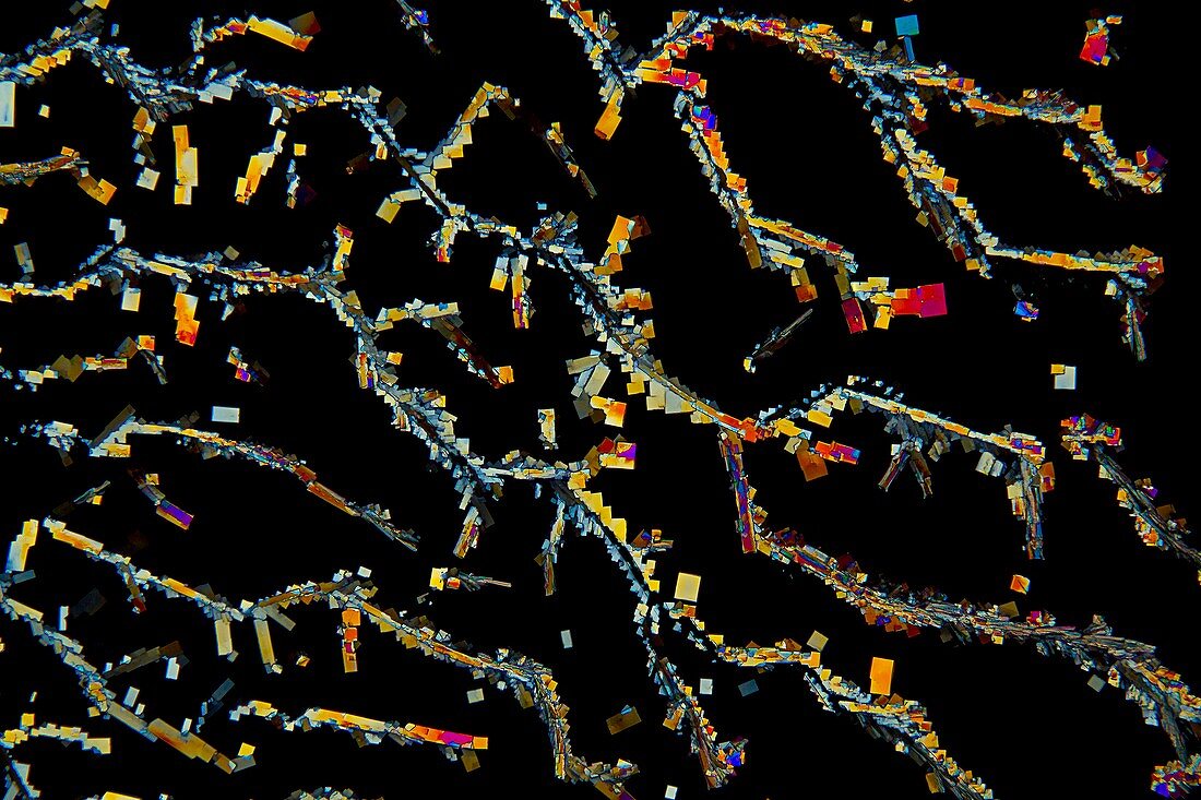 Creatinine crystals, light micrograph
