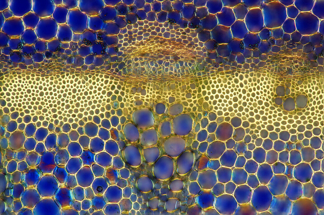 Lily (Lilium sp.) stalk, light micrograph