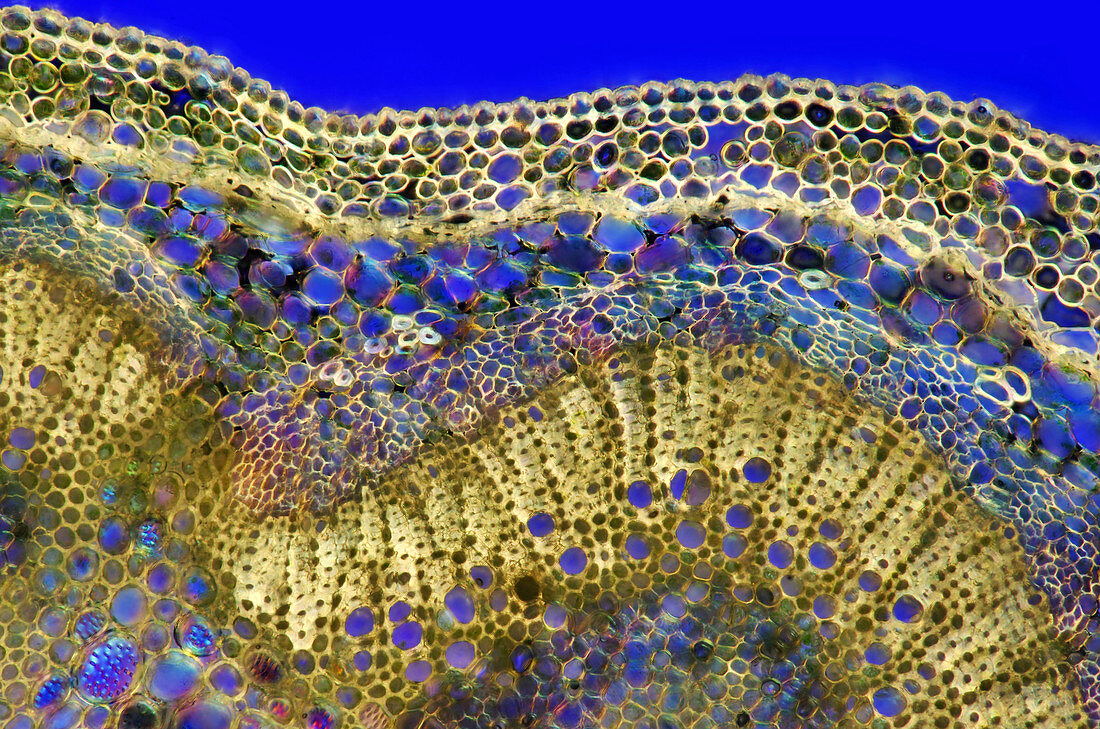 Peony (Paeonia sp.) stalk, light micrograph