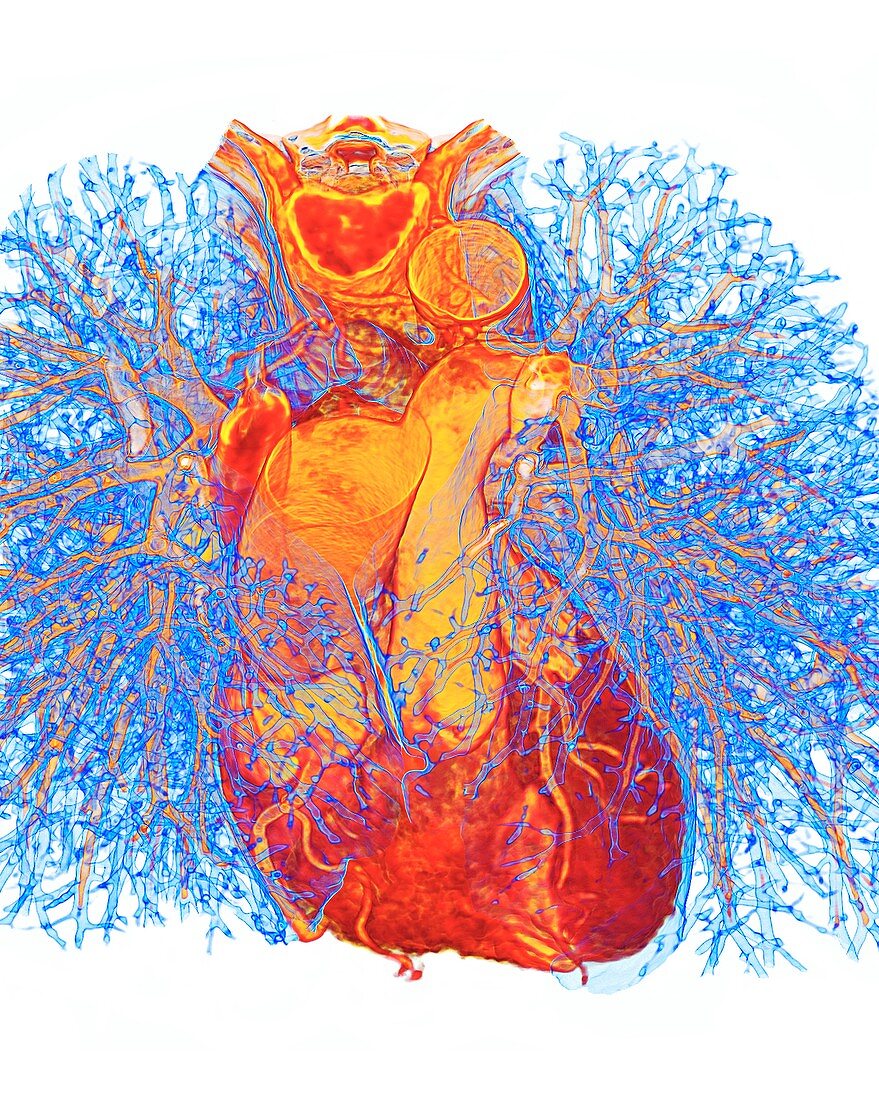 Heart and lung bronchioles, 3D CT scan