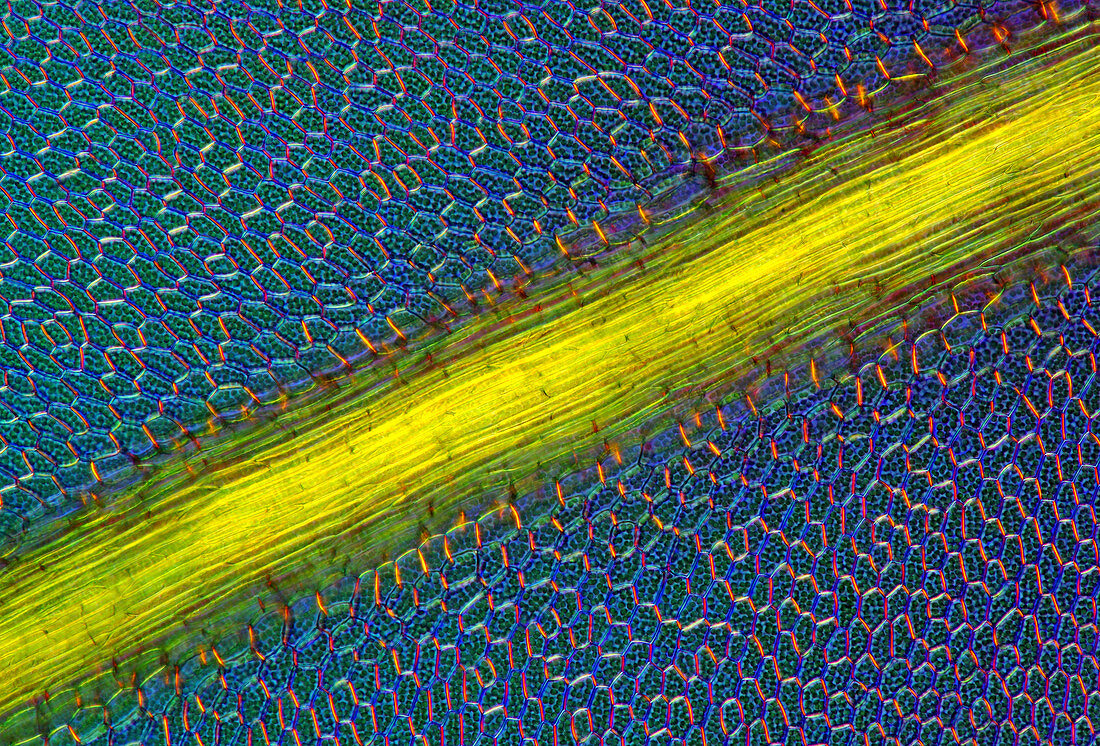 Moss leaf, light micrograph