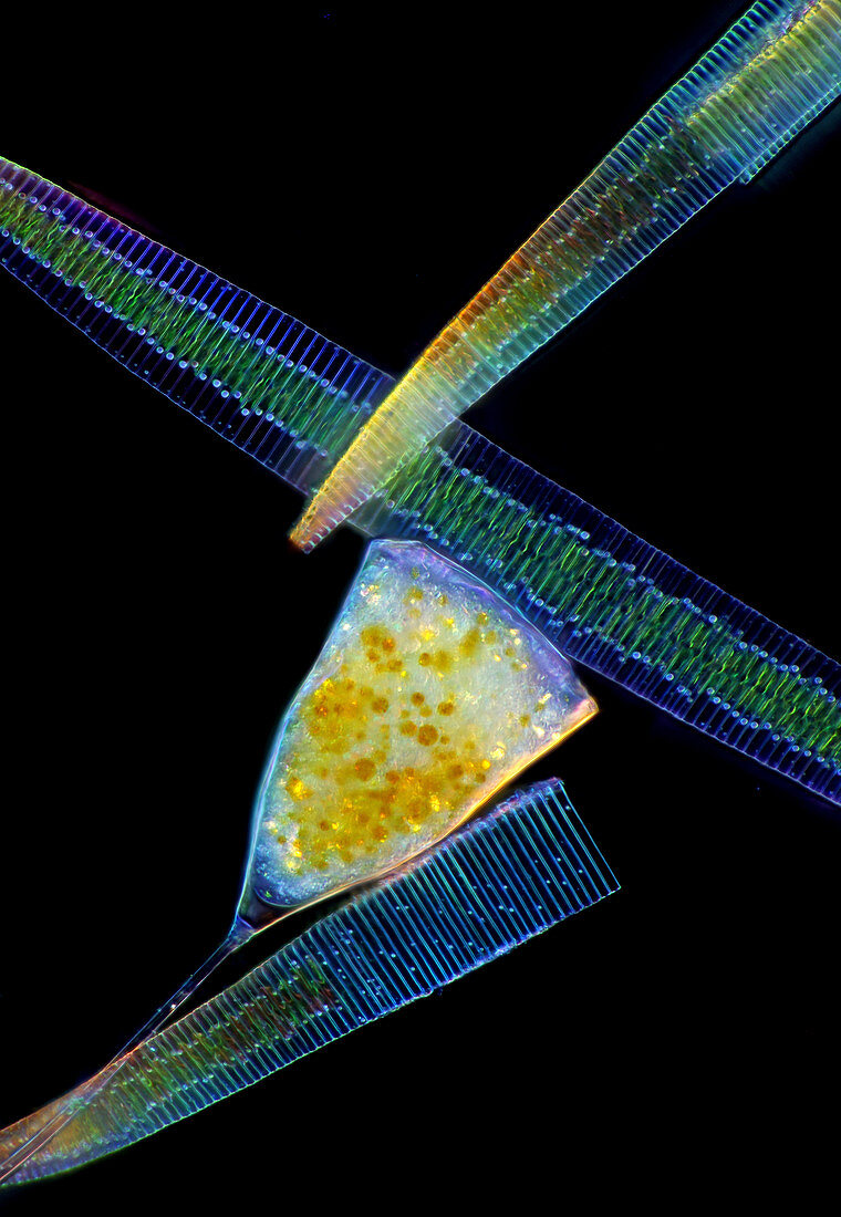 Suctorian protozoan and fragilaria diatoms, light micrograph