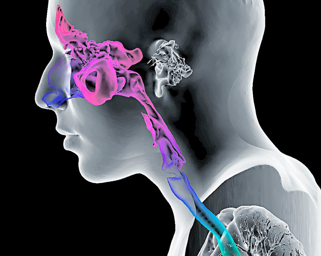 Paranasal sinuses and throat, 3D CT scan