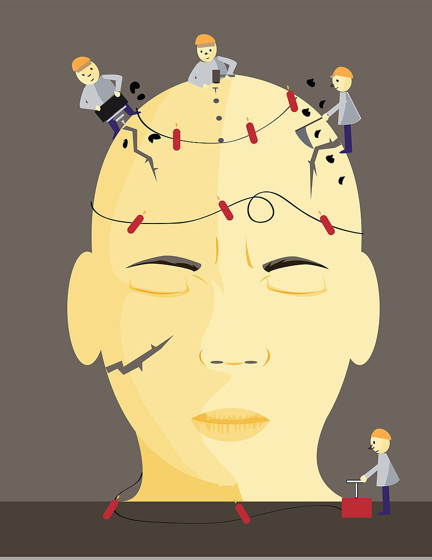 Conceptual illustration of migraine