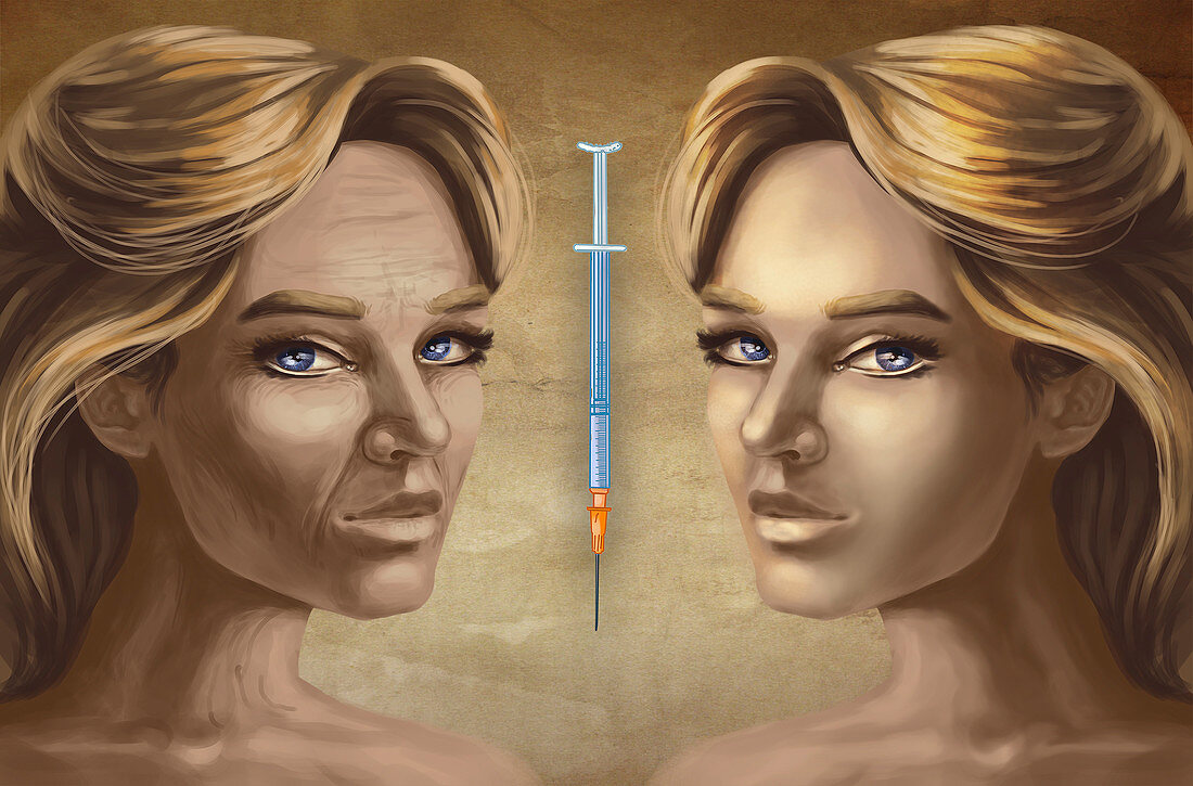 Cosmetic surgery, illustration